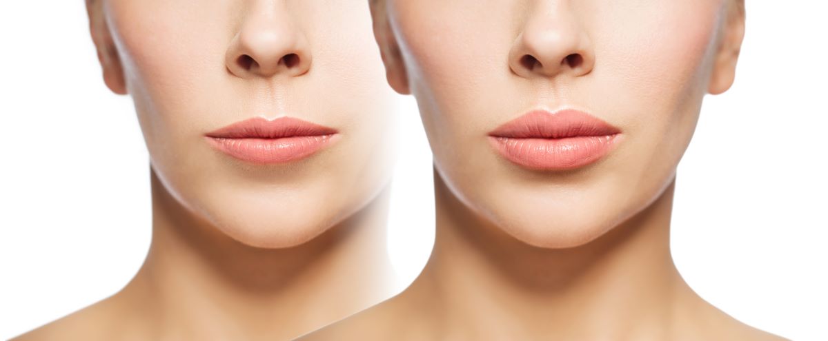 changes after cosmetic procedure