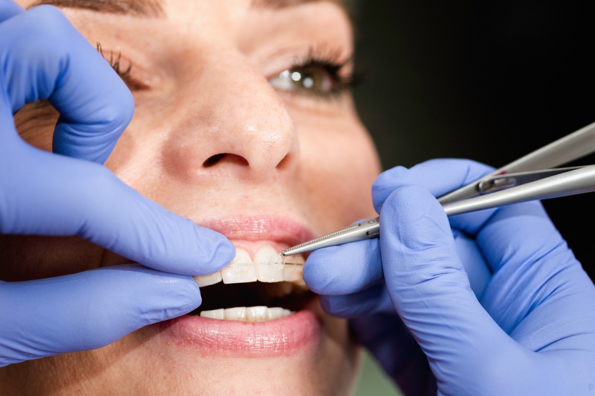 woman getting braces