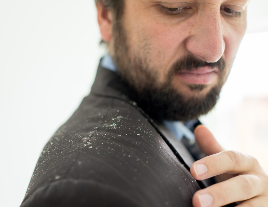 A person with Seborrheic Dermatitis having dandruff on his suit